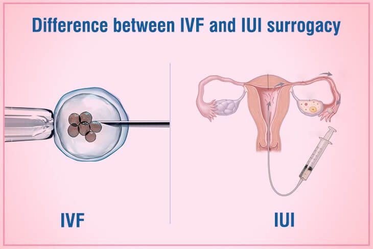 Difference between IVF and IUI Surrogacy