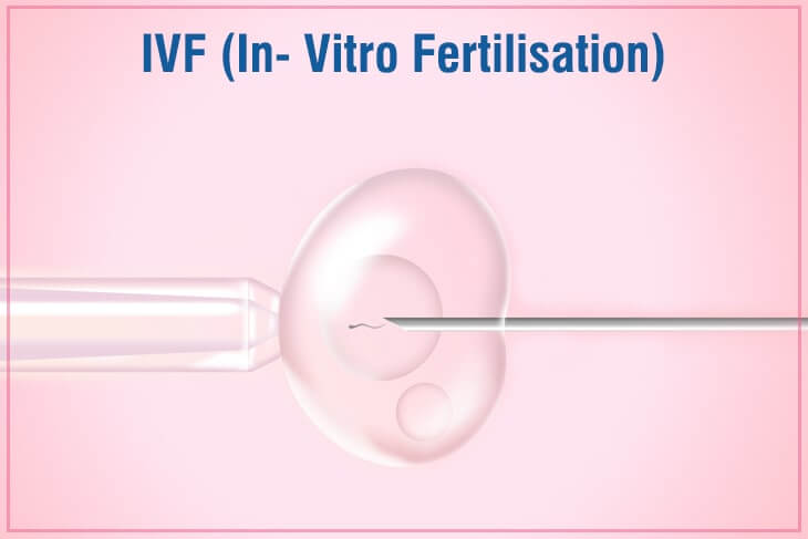How to prepare your body for IVF?