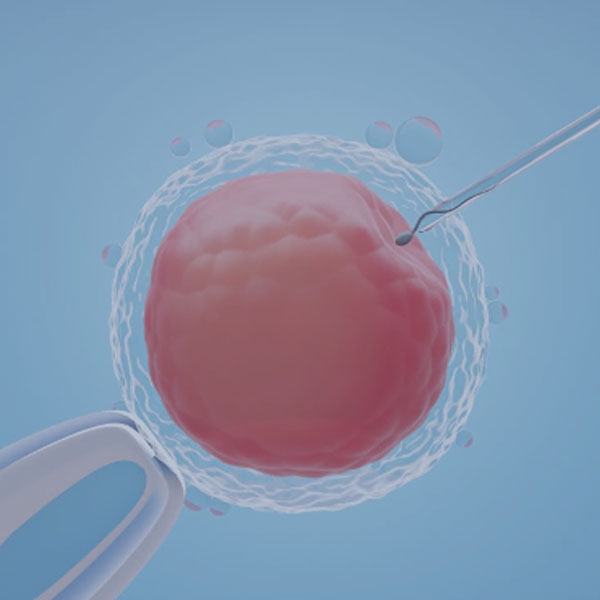 Intrauterine Insemination - Sudha Fertility Centre